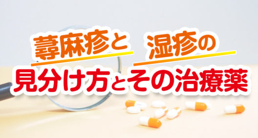 蕁麻疹と湿疹の違いとその治療薬