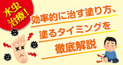 水虫治療！　効率的に治す塗り方、塗るタイミングを徹底解説
