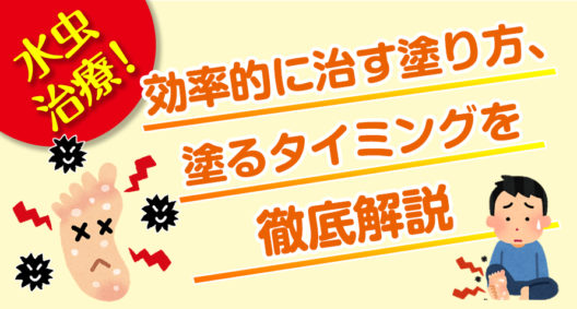 水虫治療！　効率的に治す塗り方、塗るタイミングを徹底解説